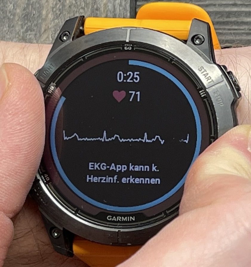 GARMIN FENIX 7 PRO UND GARMIN EPIX PRO EKG AKTIVIEREN - TUTORIAL/ANLEITUNG KURZVERSION EKGTEST